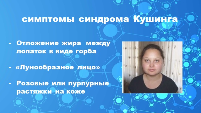 Основные причины остеопороза у женщин после 60 лет